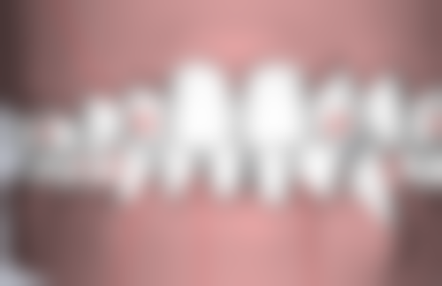 重庆北碚亦菲欧口腔收费标准参考