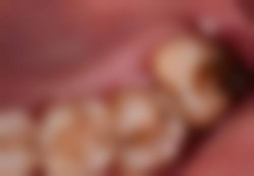 新疆伊犁伊宁瑞北雅齿口腔口碑如何?