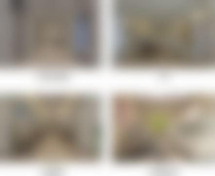 西安新城团圆口腔医院根管治疗(前牙)的技术优势有哪些?