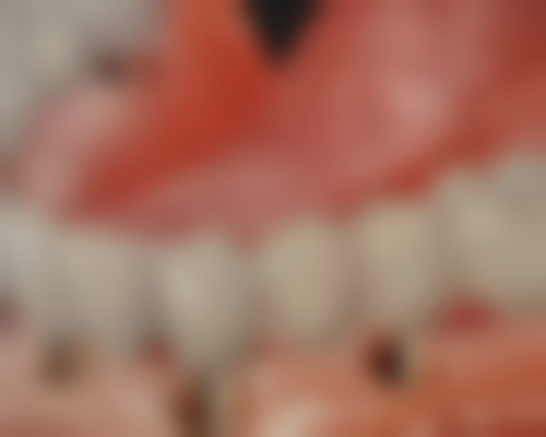 深圳市口腔医院收费标准参考