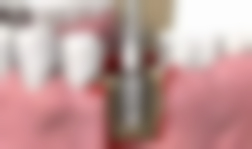 珠海六和口腔醫院（澳門院區）梁展朋医生口碑评价如何？