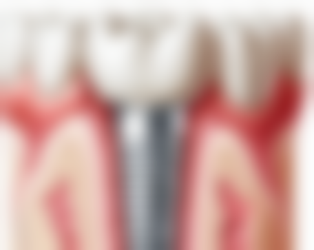 濮阳雅美口腔诊所王好星医生技术好不好？