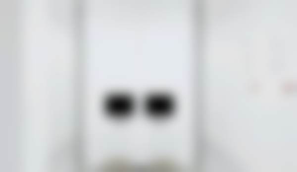 成都西南口腔医院周力金属托槽矫正怎么样？5888全包半年牙齿变整齐