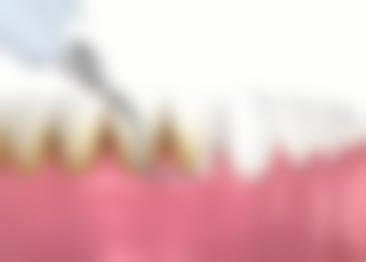 广州贝芽口腔门诊收费标准参考