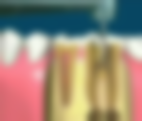 南京康贝佳口腔分院怎么选？四大院区特色解析