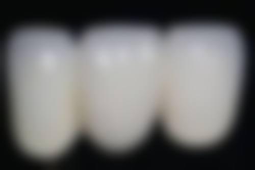 总结——雁塔优德口腔门诊部怎么样？