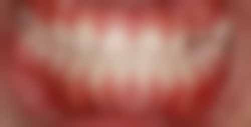 威海荣成润明口腔口碑如何?