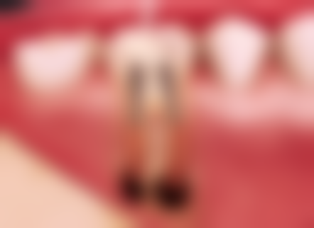 遵义铂菲口腔门诊部口碑如何?