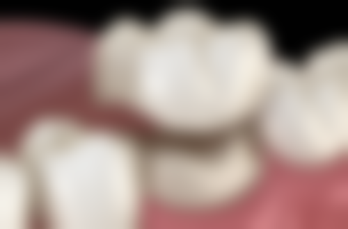 重庆德贝口腔诊所阚兴伟医生技术好不好？