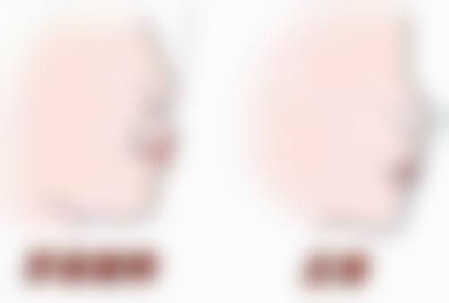 新疆哈密众安口腔医院技术好不好？