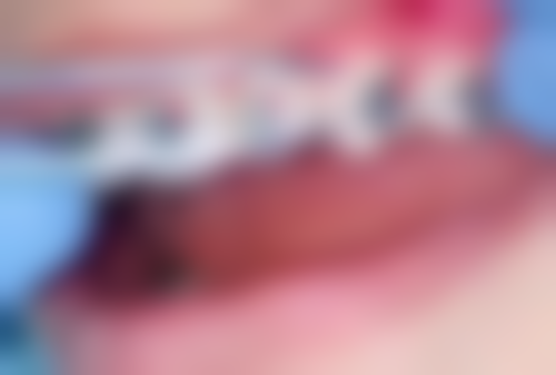 大康桥口腔门诊部收费标准参考