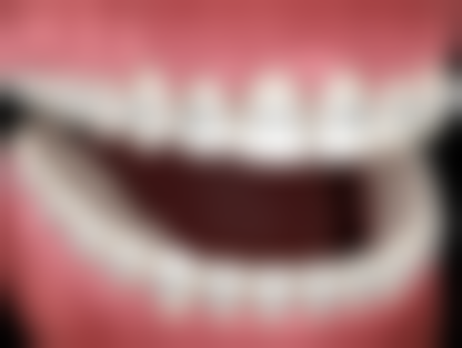 佛山北泉口腔门诊部汤健祥医生挂号预约攻略