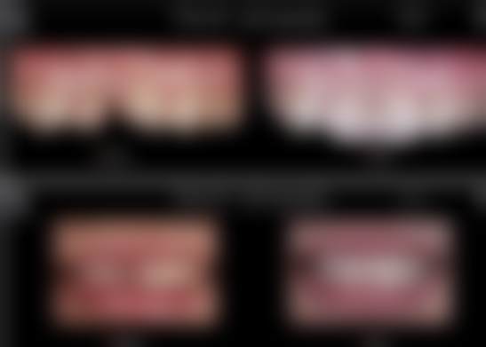 总结——南京美奥口腔门诊部怎么样？