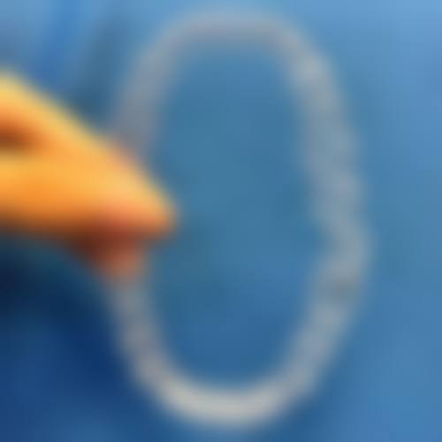 长沙伢好口腔医院技术好不好？