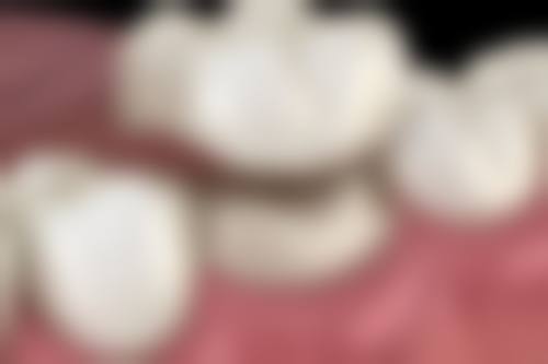 山东济南莱芜牛海英口腔口碑如何？