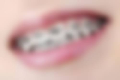 总结——江苏苏州国仕口腔怎么样？