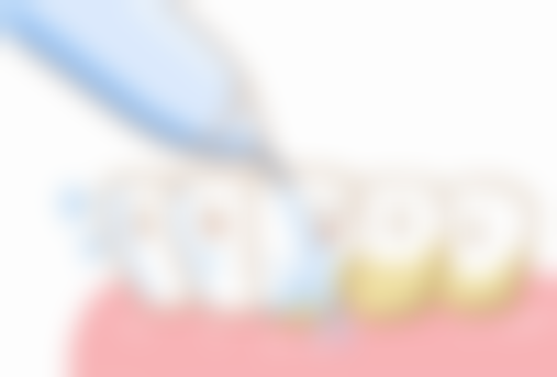 苏州丁月峰口腔(江兴西路店)收费标准参考