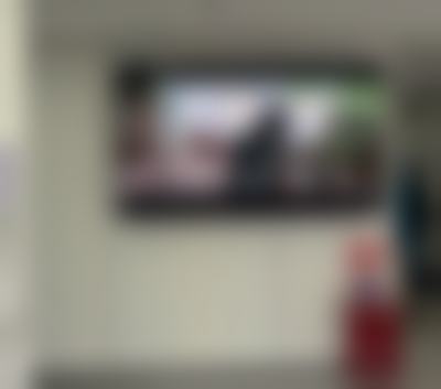 深圳格伦菲尔口腔乔磊院长种植牙！塞牙不敢笑的我终于开怀大笑