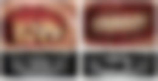 南京美奥口腔郑台镛医生做儿童颜面干预功能性矫治技术好吗？