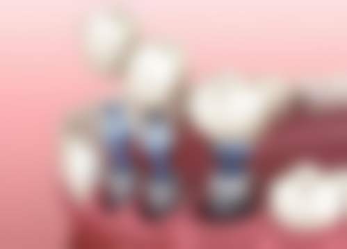 深圳卫佳康泰华口腔口碑如何？