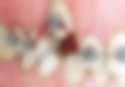 深圳卫佳康泰华口腔电话号码及预约方法