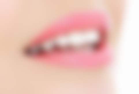 深圳卫佳康泰华口腔医院技术好不好？