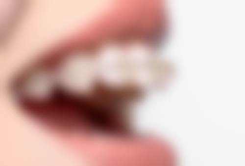 温州乐清市齿逸口腔地址