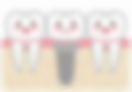 如何延长根管治疗后牙齿的使用时间