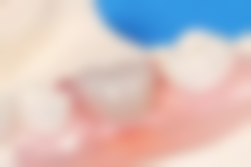 深圳正夫口腔醫院(東門旗艦店)电话号码及预约方法