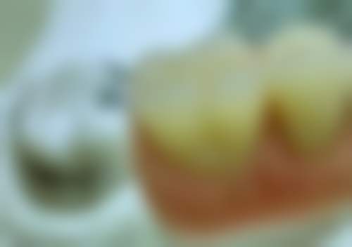 青岛坤昊口腔连锁（黄岛区）医院技术好不好？