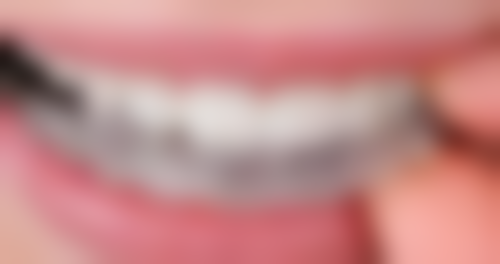 总结——云南大理宾川县吉美口腔怎么样？