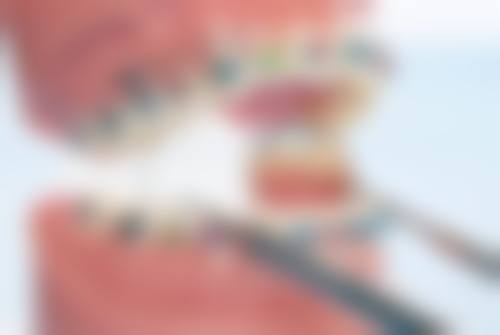 总结——湖南长沙致雅口腔亚非院怎么样？