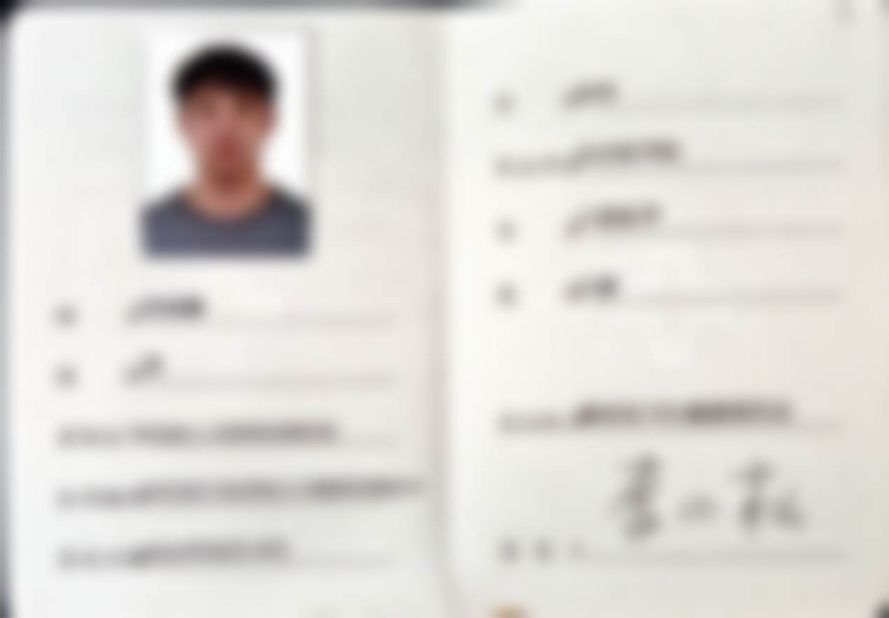 岳阳牙歪歪口腔科普:儿童玻璃离子补牙适合哪些孩子?