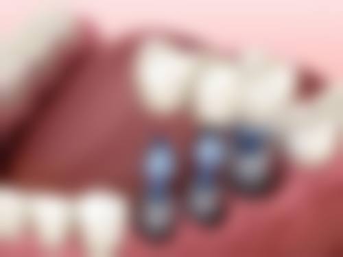 深圳龙城医院口腔科口碑如何？