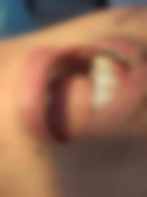 珠海六和口腔醫院(澳門院區)李昊医生口碑评价如何?